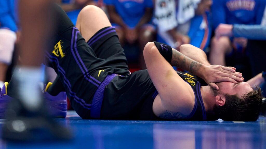 Luka Doncic infortunato con i Lakers